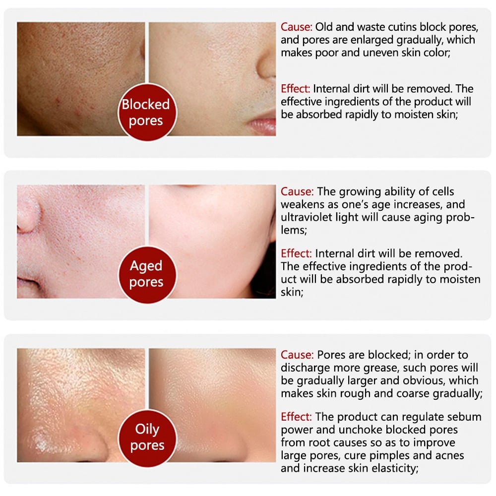 (💥BUY 1 GET 1 FREE⏰) 2023 New Magical Pore Eraser Waterproof FacePrimer Stick